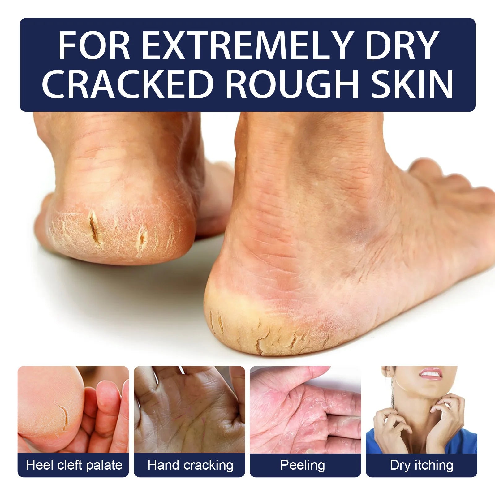 Jaysuing Heel & Hand Repair Cream | Nourishing Moisture 30g