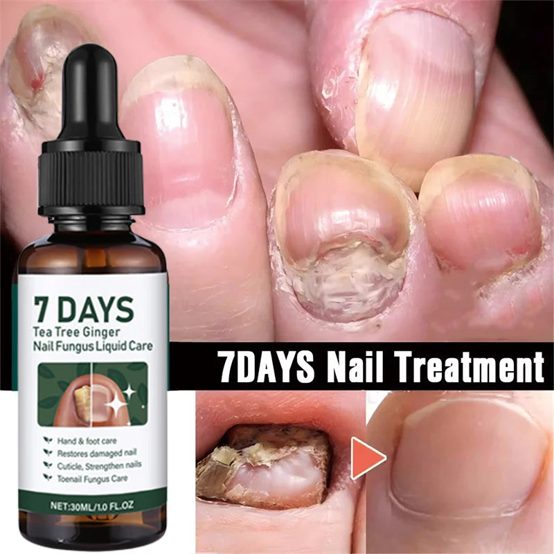 Eelhoe Nail Repair Serum – Ginger Extract for Healthy Nails Nail Repair Serum Oasis Select