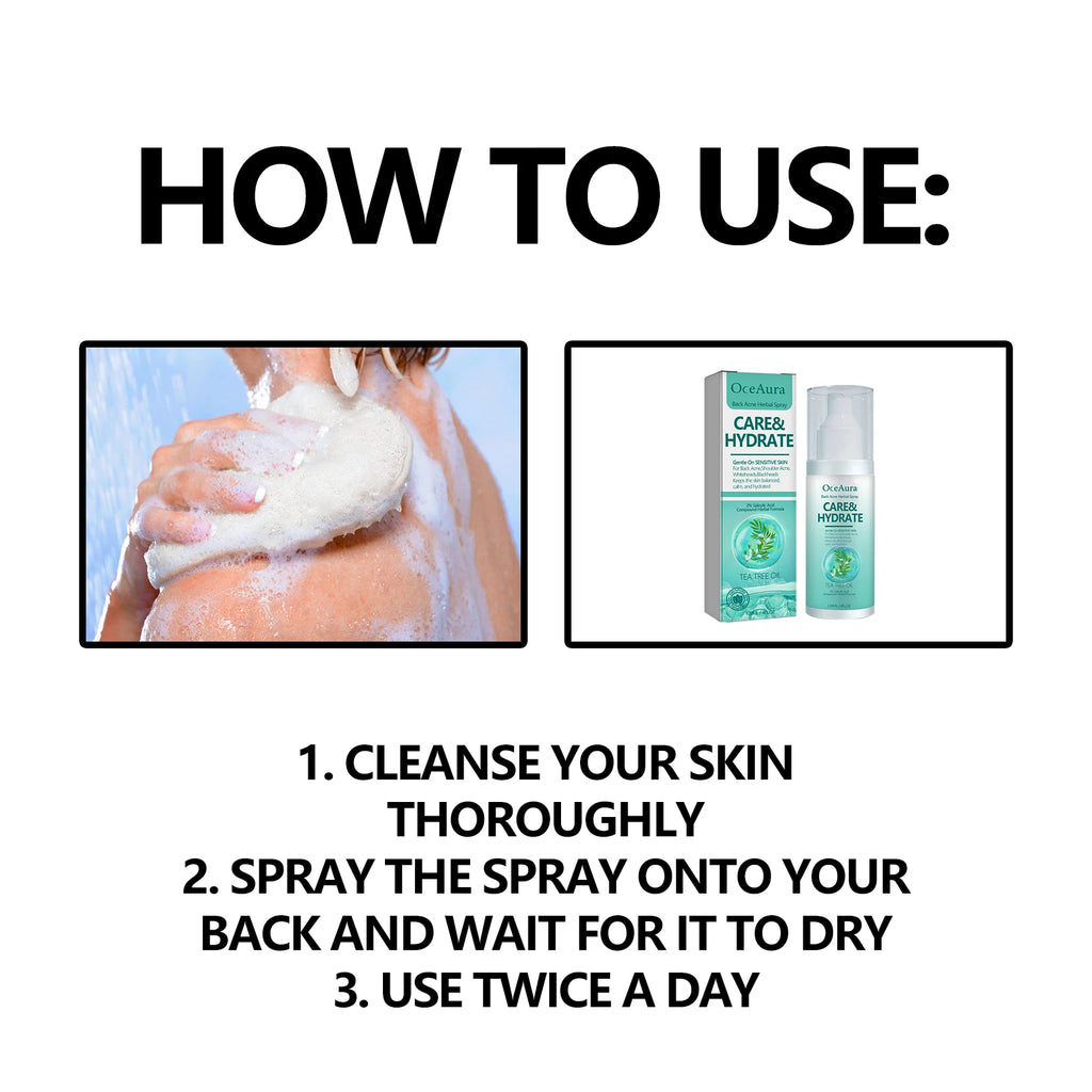 Herbal Acne Remover Spray Back Shoulder Pimple Treatment Blackhead Anti Mites Oil Control Repair Smooth Skin Care Beauty Health Oasis Select