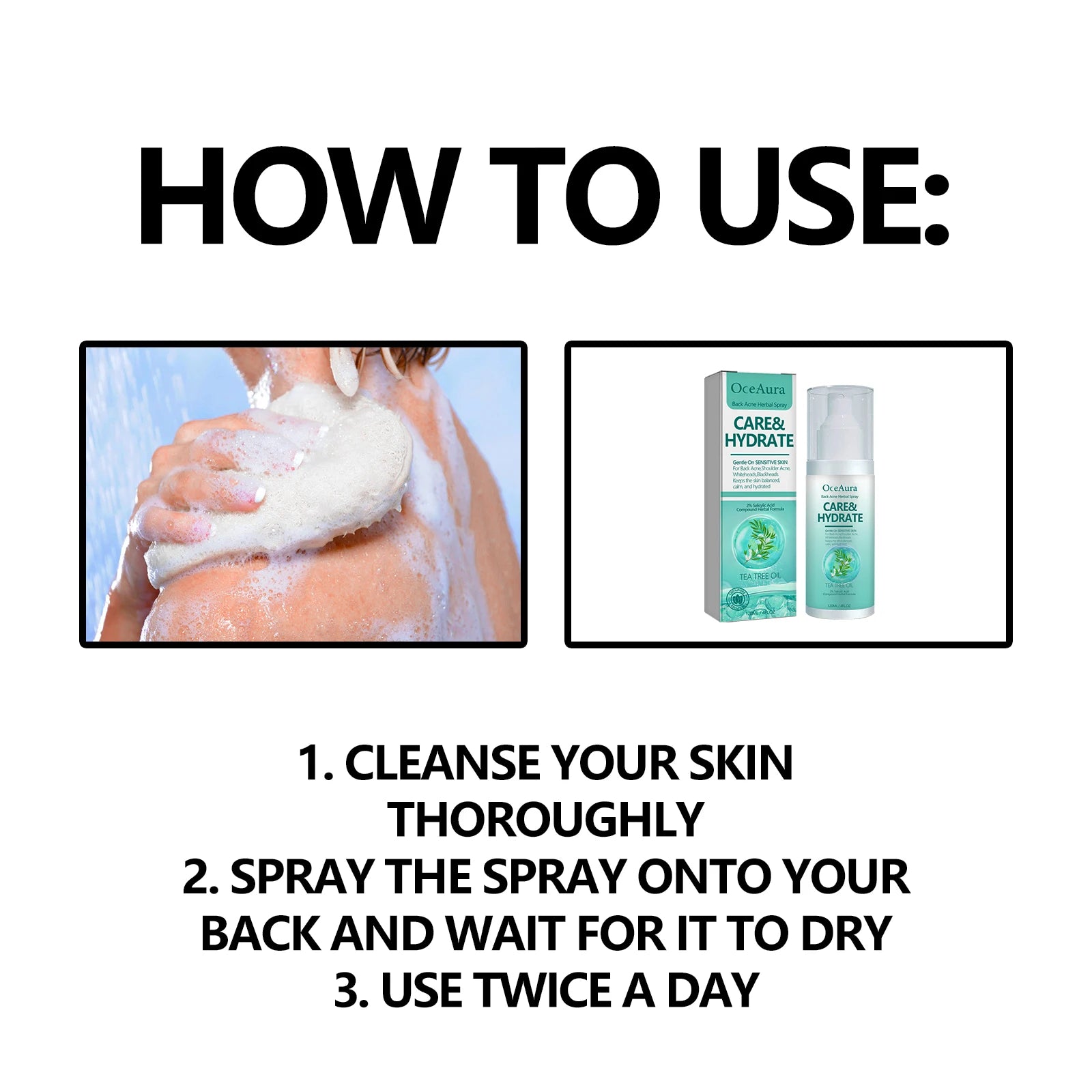 Herbal Acne Remover Spray Back Shoulder Pimple Treatment Blackhead Anti Mites Oil Control Repair Smooth Skin Care Beauty Health Oasis Select