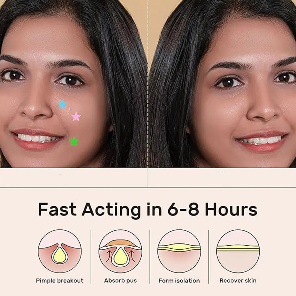 Colorful Hydrocolloid Dots Cute Star Heart Shaped Acne Pimple Patch For Face Invisible Zits & Blemishes Cover Stickers Skin Care Oasis Select