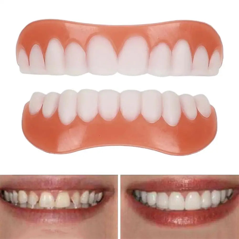 Soft Silicone Denture Kit – Upper & Lower Teeth Set Silicone Denture Kit Oasis Select