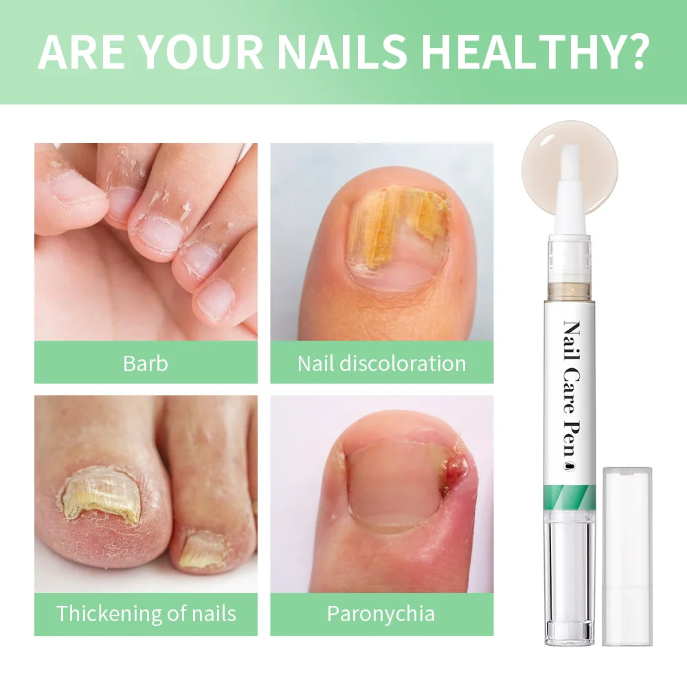 Nail Care Pen Nourish and Moisturize Nails Prevent Fungal Infections Improve Appearance Flat Brush Head Design Daily Nail Care Oasis Select