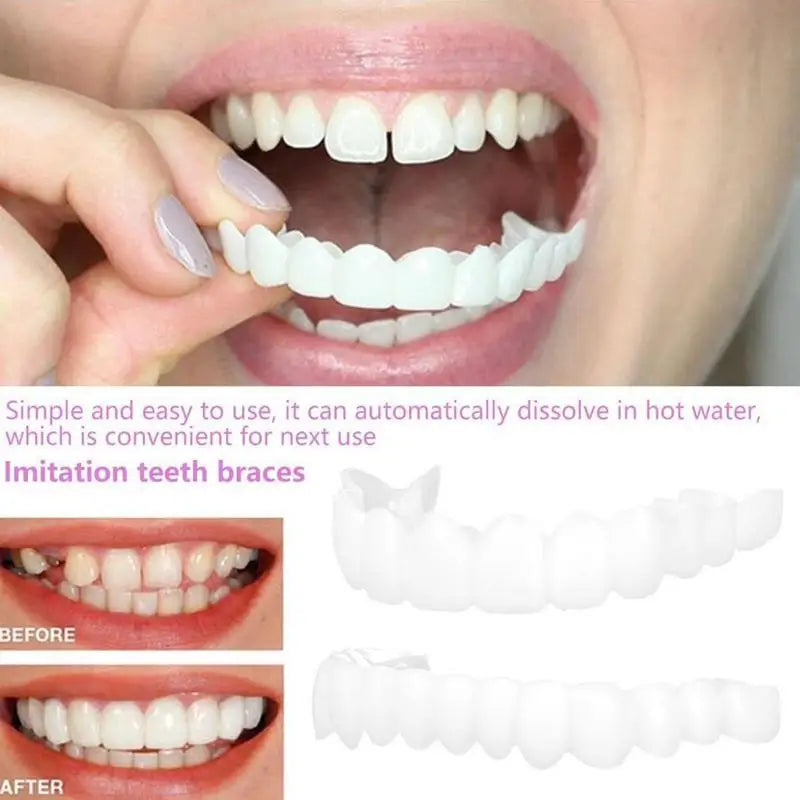 Snap-On Teeth Veneers – Reusable Smile Cover for Men & Women Cosmetic Dental Veneers Oasis Select