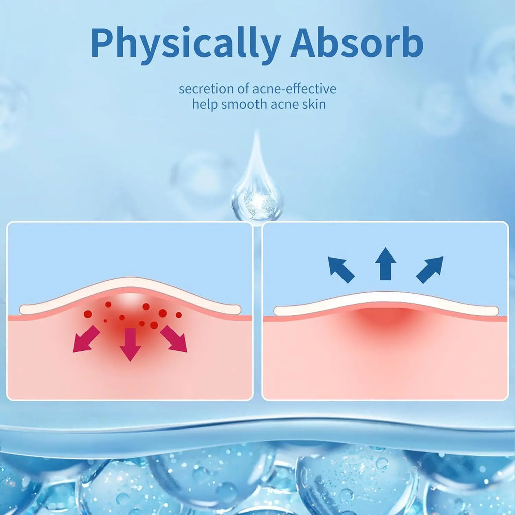 Hydrogel acne removing patch (2 shapes), 190/380 pieces/box, deep cleaning acne removing patch, effective acne removing patch Oasis Select