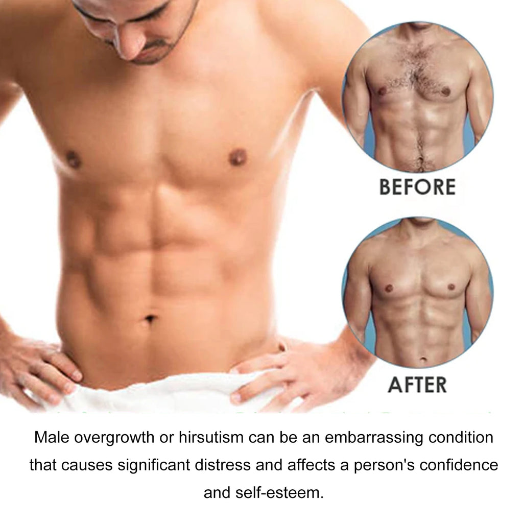 Hair Removal Cream Painless Beard Chest Hair Growth Inhibitor Mild Effective Armpit Leg Private Part Epilation Depilatory Cream Oasis Select