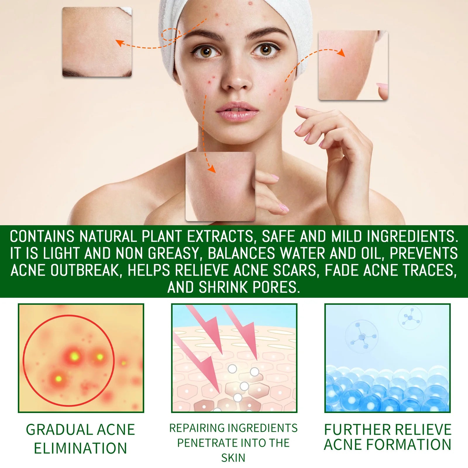 Salicylic Acid Anti Acn-e Face Serum Hydrating Fader Acne Mark Pimple Blackhead Removal Shrink Pores Oil Control Facial Essence Oasis Select