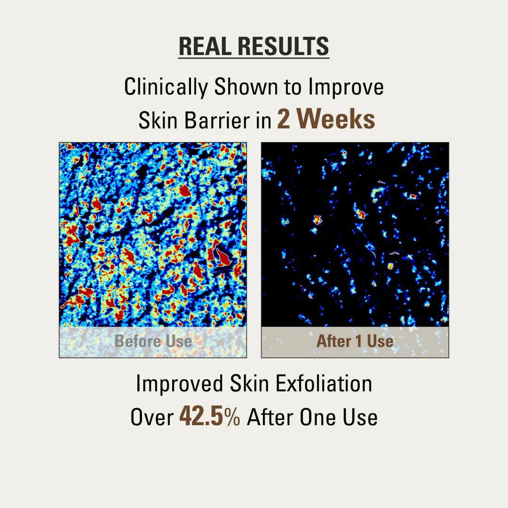 Rice Jam Face Mask – Brightening, Hydrating & Pore Minimizing