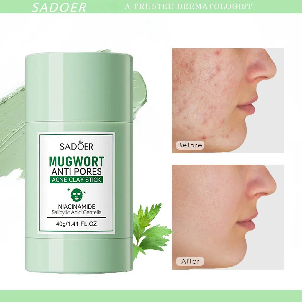 Mugwort Clay Stick Anti-Acne Clay Mask for Clean Pores and Blackheads Improve Acne Prone Skin 40g Oasis Select