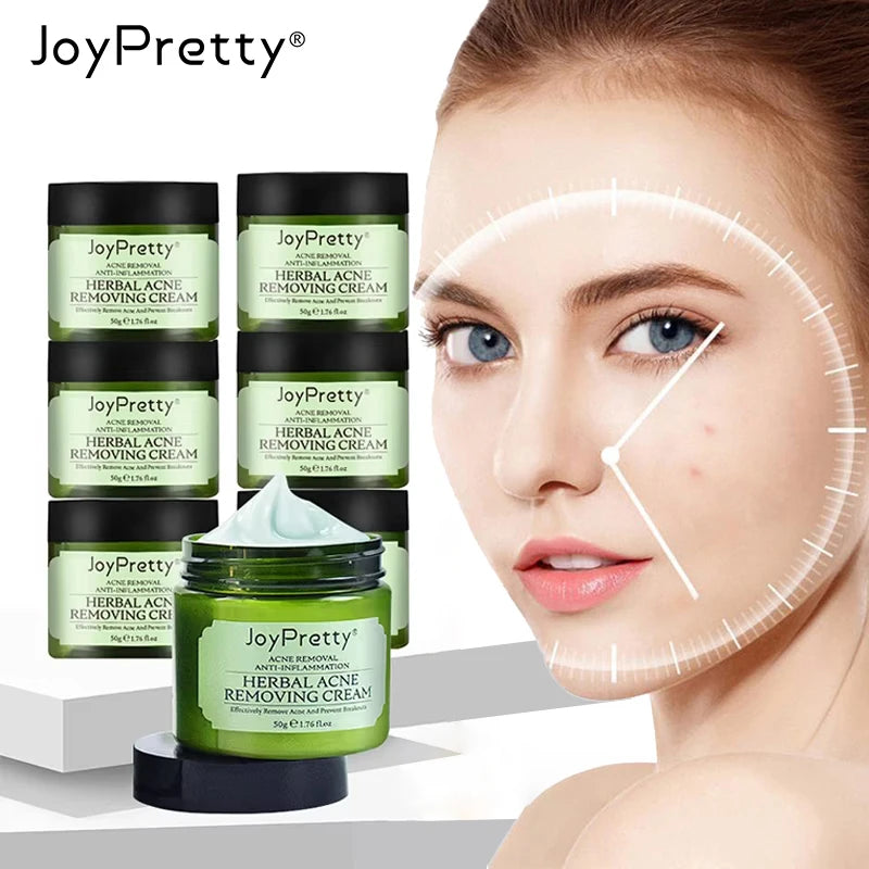 Blackhead Remover Face Cream Enlarged Pores Removal Oil Control Pore Shrinkage Facial Cream Skin Care Set Beauty Health Oasis Select