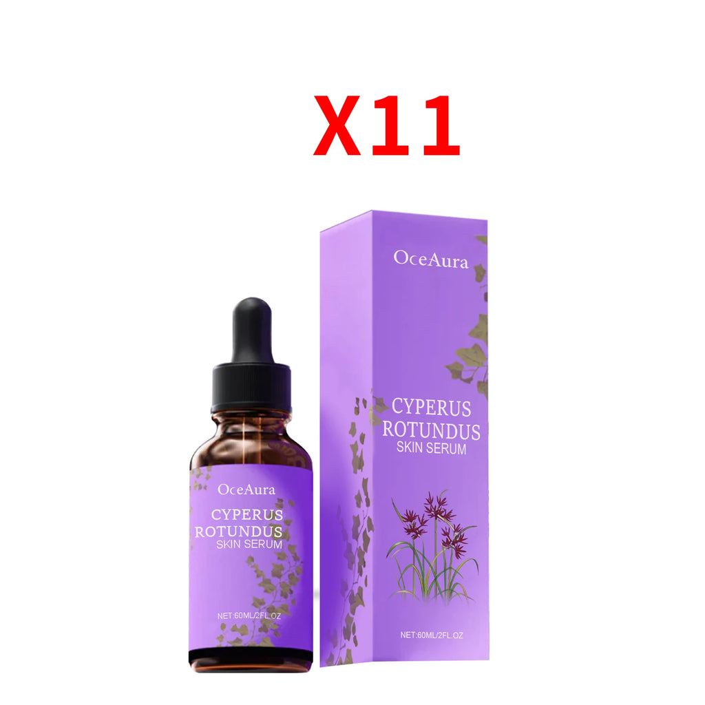 Cyperus Rotundus Serum Hair Growth Inhibitor Soothing Moisturizing Depilatory Refreshing Slowing Reduction Body Hair Growing Oil Oasis Select 660ml boxed
