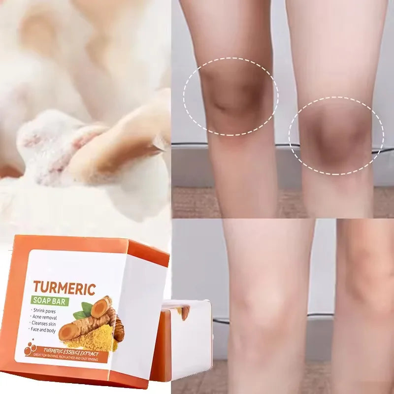 Natural Turmeric Soap Body Cleaning Lightening Dark Underarm Leg Bath Cleansers Brightening Face Soap Tender Skin Care Beauty Oasis Select