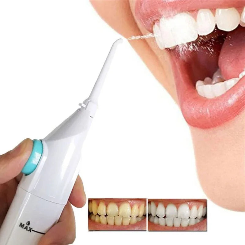 1PC Portable Electric High-Pressure Water Flosser Manual Pulse Jet Dental Teeth And Gums Cleaner Deep Cleaning Oral Irrigator Oasis Select