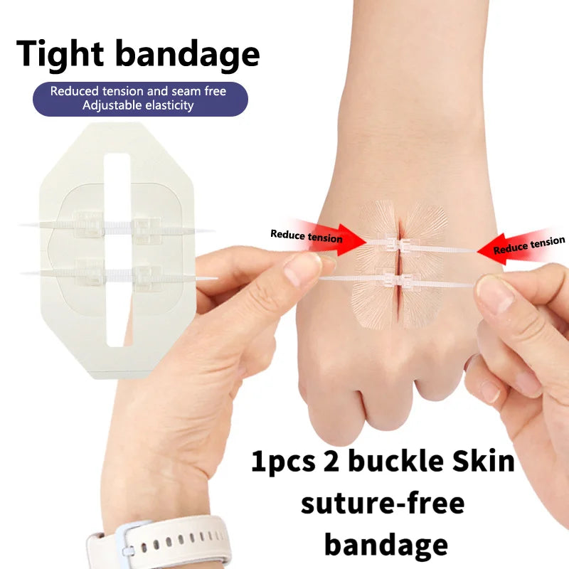Emergency Wound Closure Zip Stitch Sutures Bandaids Repair Wounds Without Stitches For Outdoor Activities Quick Clot Wound Oasis Select 02