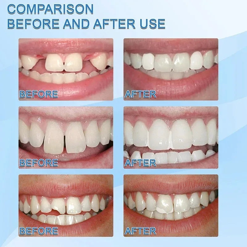 Temporary Tooth Repair Kit Teeth And Gaps False Teeth Solid Glue Denture Adhesive Teeth Whitening Tooth Beauty Oasis Select