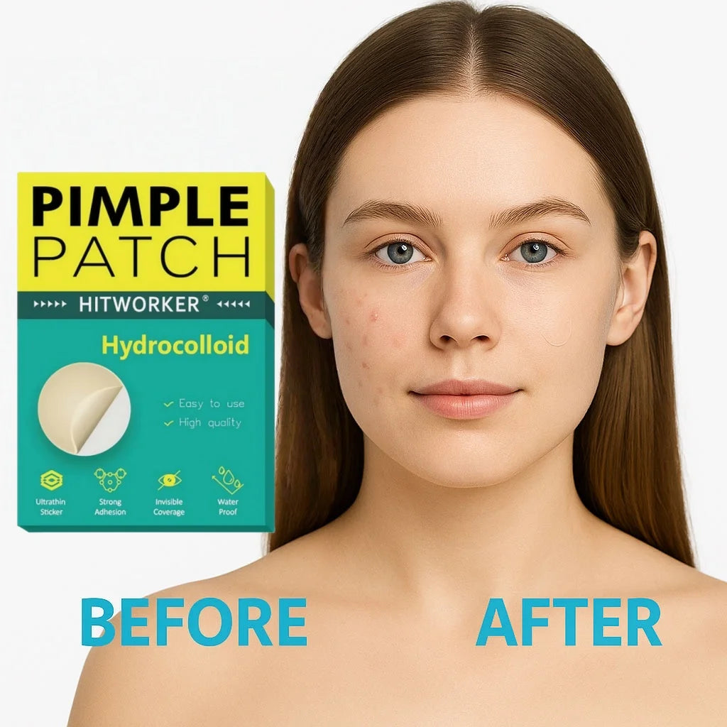 400 pieces/box of skin color colloidal acne patch - alcohol free, odorless acne mask patch, suitable for both men and women Oasis Select