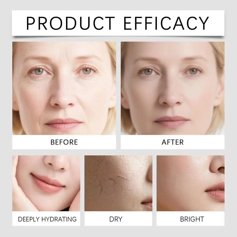 Hyaluronic Acid Face Serum & Microneedle Roller Set 4×10ml Face Serum Set Oasis Select
