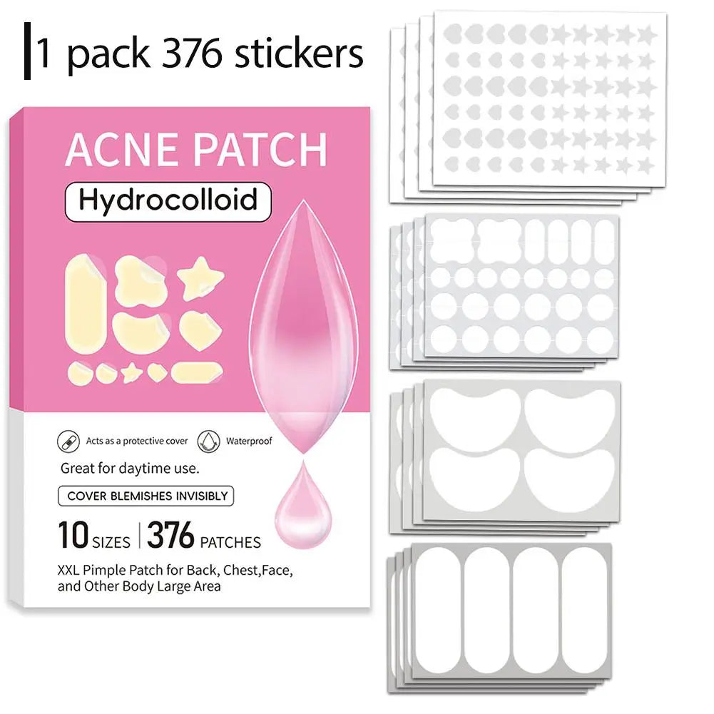 Hydrocolloid Pimple Patches Bulk – 5 Sizes, Up to 532 Pcs Acne Pimple Patches Oasis Select 376pcs