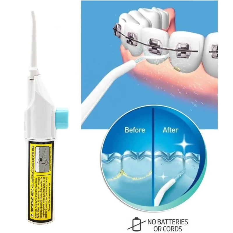 1PC Portable Electric High-Pressure Water Flosser Manual Pulse Jet Dental Teeth And Gums Cleaner Deep Cleaning Oral Irrigator Oasis Select