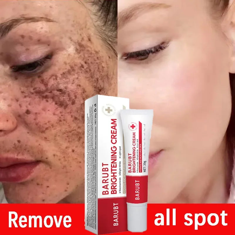 Brightening Dark Spot Corrector Cream – Niacinamide & Vitamin C