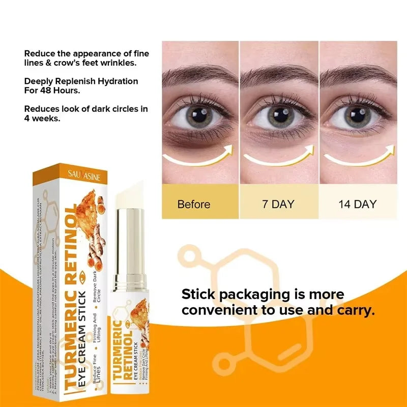 SADOER Retinol Eye Cream – Brighten, Firm & Hydrate Eye Cream Oasis Select