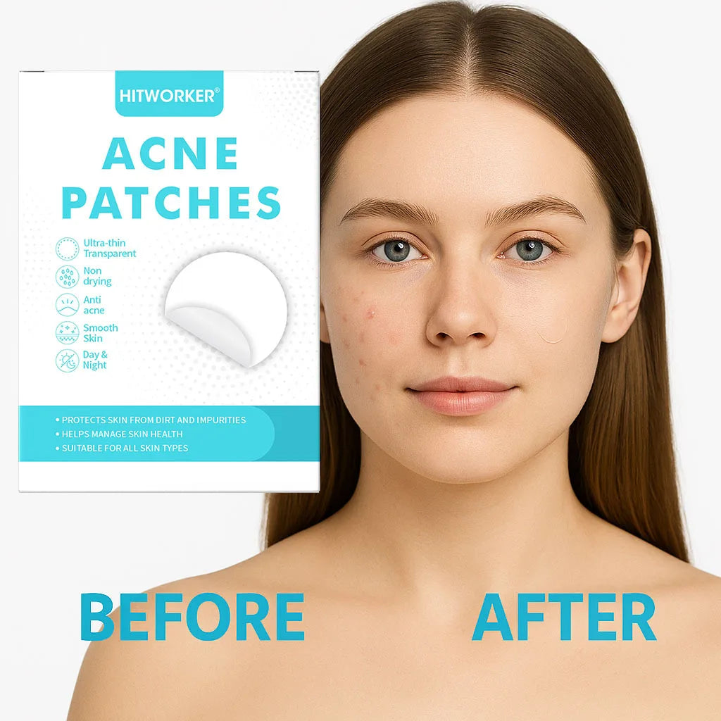 720/360/180 pieces/box colloidal acne patch - alcohol free, non irritating acne mask patch, suitable for all skin types Oasis Select