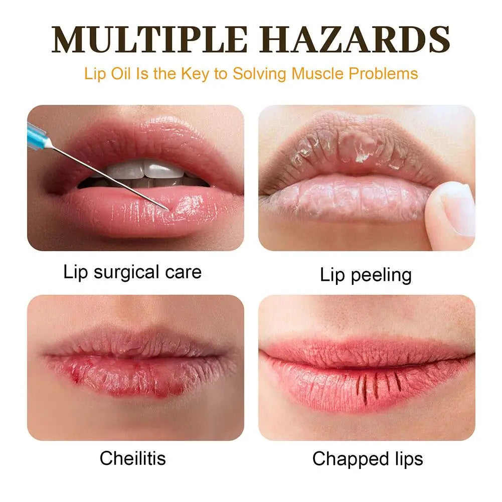 Eelhoe Honey Lip Oil – Hydrating Overnight Lip Balm & Gloss 5g Honey Lip Oil Oasis Select