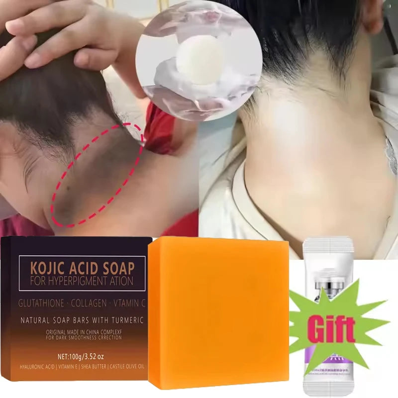 Kojic Acid Brightening Soap – Dark Spot & Deep Cleanse Bar