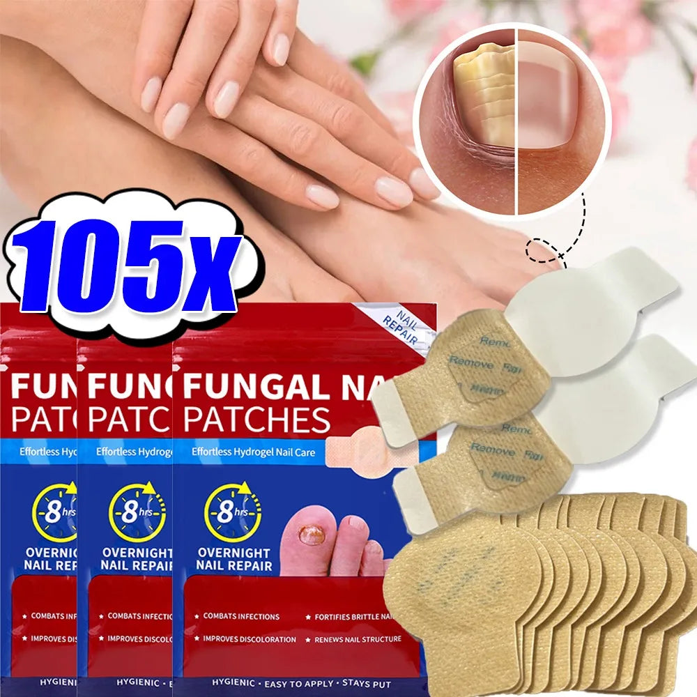 Nail Repair Patches – Ingrown Toenail & Nail Care Stickers Nail Care Patches Oasis Select
