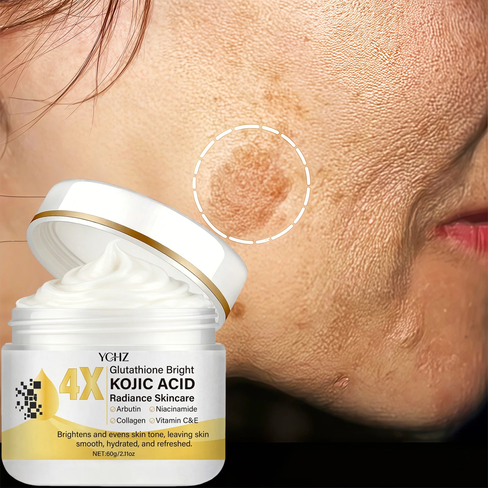 YCHZ Kojic Acid Brightening Cream – Dark Spot & Dullness 60g