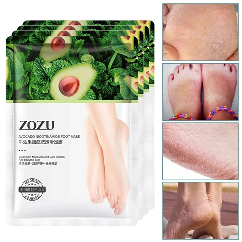5-Pair Avocado Exfoliating Foot Mask – Dead Skin Remover & Moisturizer Foot Peel Mask Oasis Select