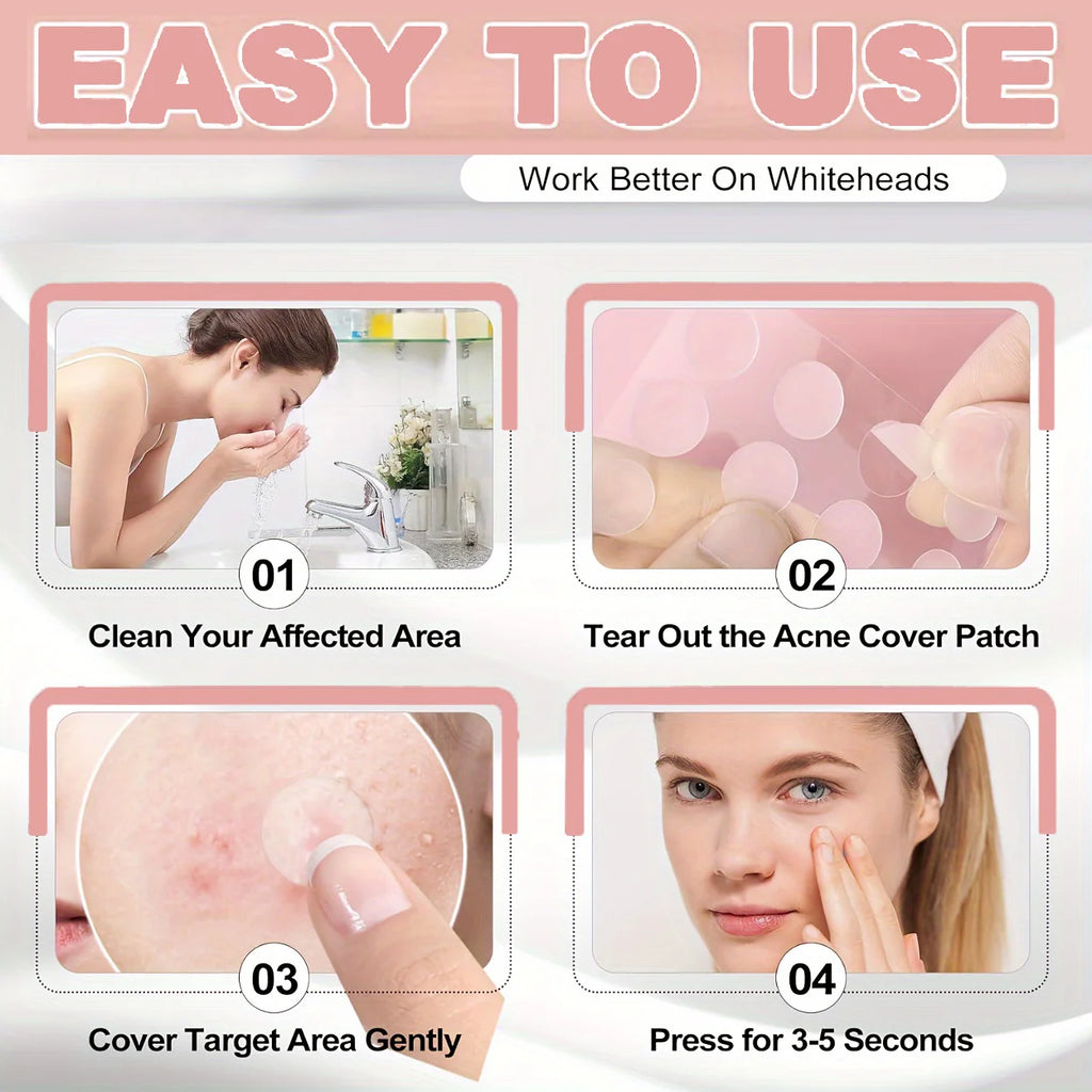 228/372pcs acne patches. Suitable for all kinds of light skin color, 24-hour protection, invisible coverage, non irritating, tea Oasis Select