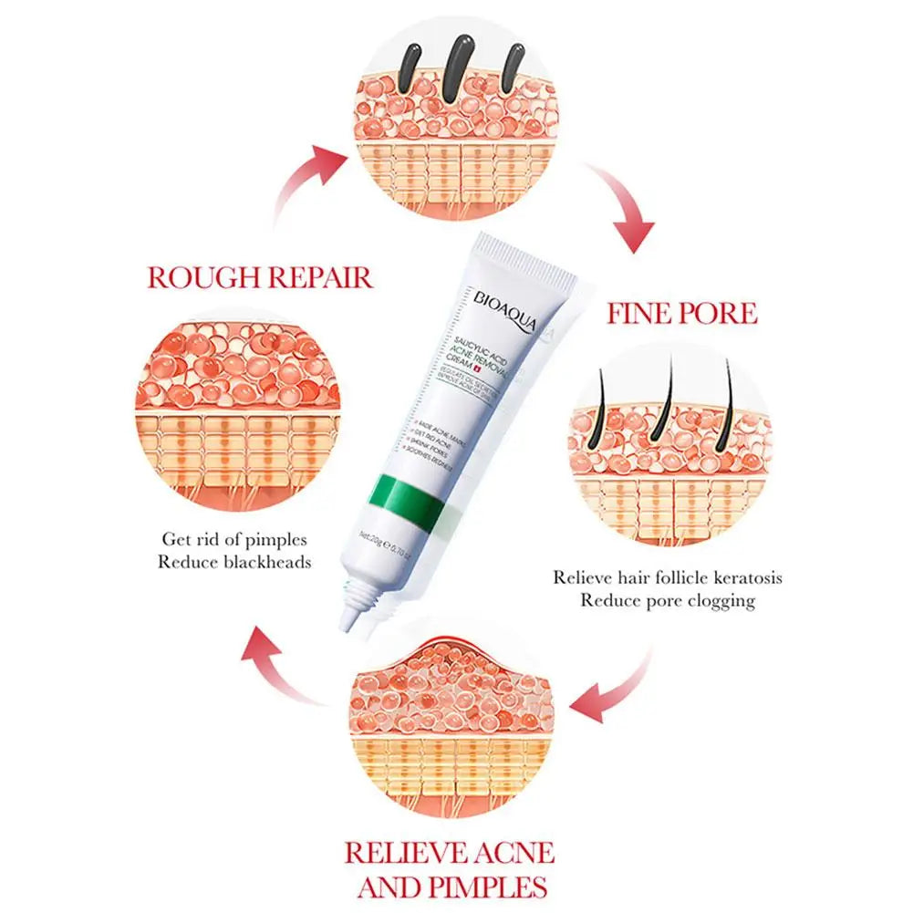 BIOAQUA Salicylic Acid Face Cream Acne Treatment Scar Mark Repair Moisturizing Blackhead Remover Facial Cleanser Skin Care Oasis Select