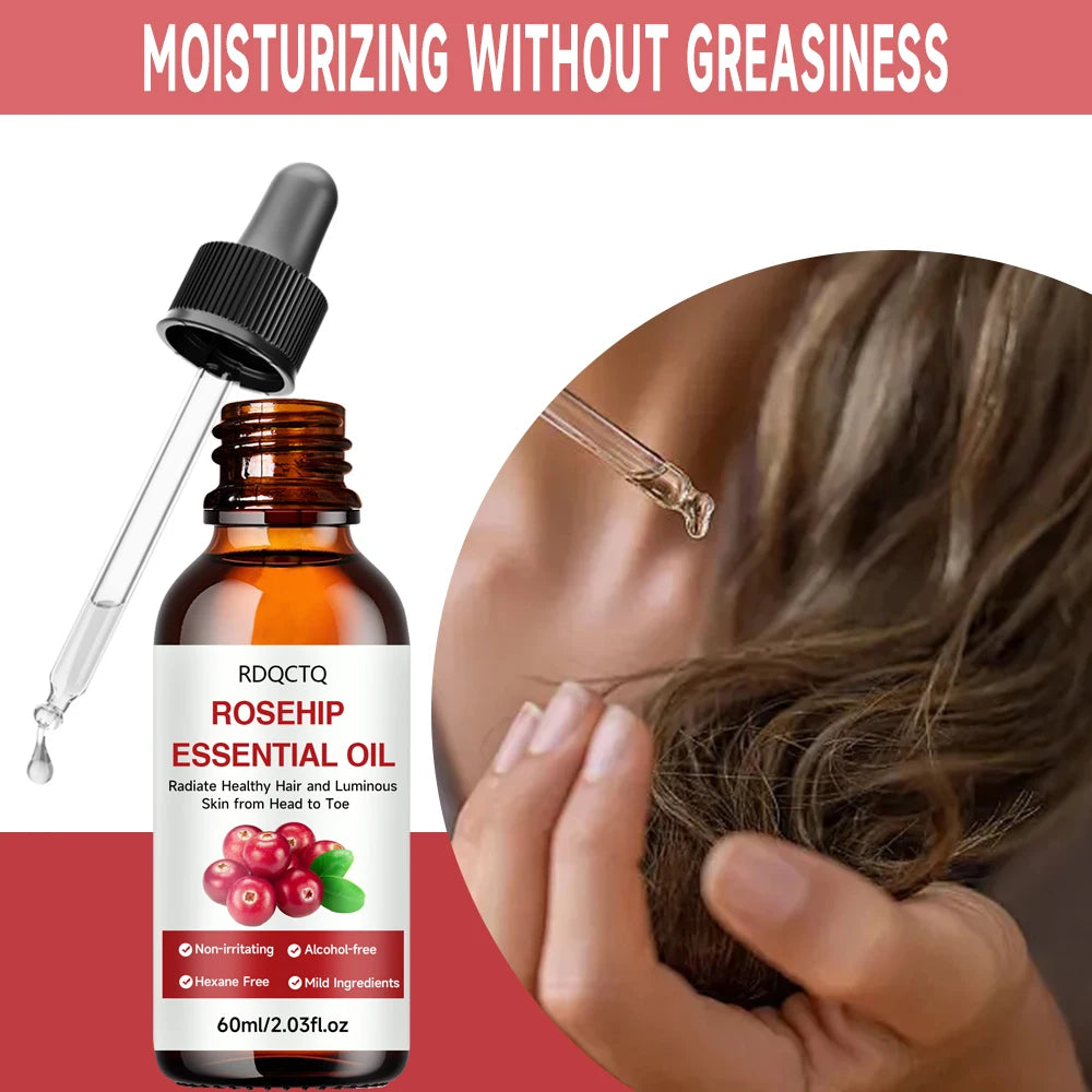 Rose Hip Oil for Hair & Skin - Pure Natural Moisturizing Essential Oil, Alcohol-Free, Nourishing Care for Healthy Look Oasis Select