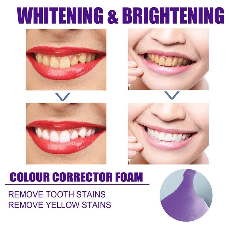V34 Whitening Toothpaste 2-Pack | Stain Removal & Fresh Breath