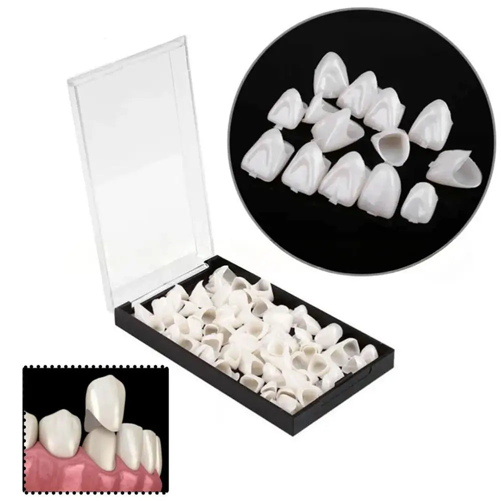 Temporary Dental Crowns Set 150pcs – Anterior & Posterior Temporary Dental Crowns Oasis Select