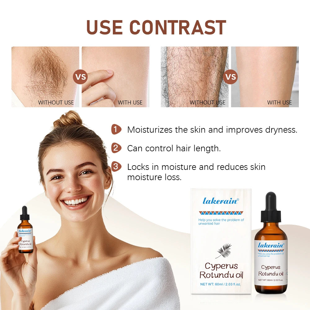 Inhibit Hair Growth 60ml Cyperus Rotundus Oil Nourish the Skin Ingredients are Safe Wide Scope of Application Solve Hair Dense Oasis Select
