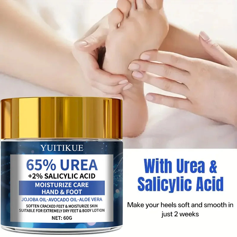 YUITIKUE 65% Urea Foot Cream – Cracked Heel Repair 60g