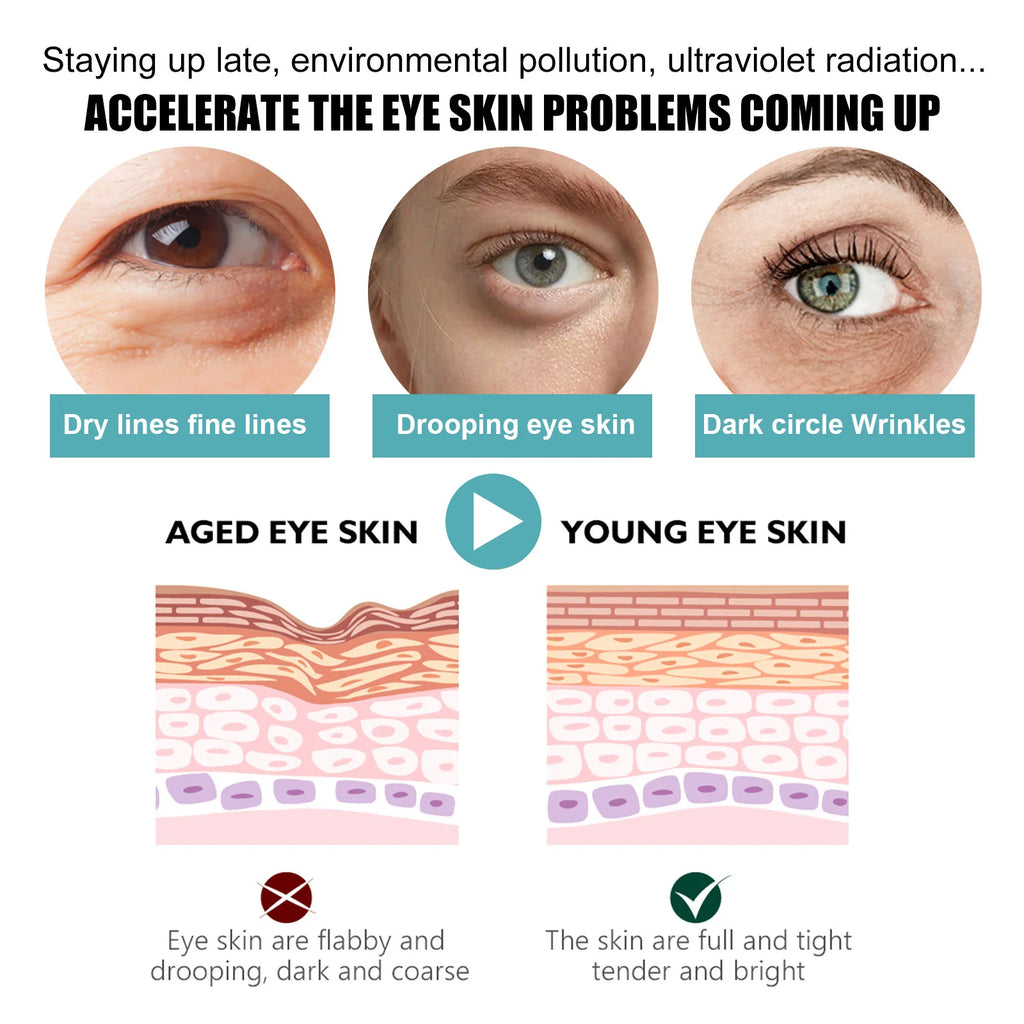 EELHOE Eye Cream – Dark Circles, Bags & Anti-Wrinkle