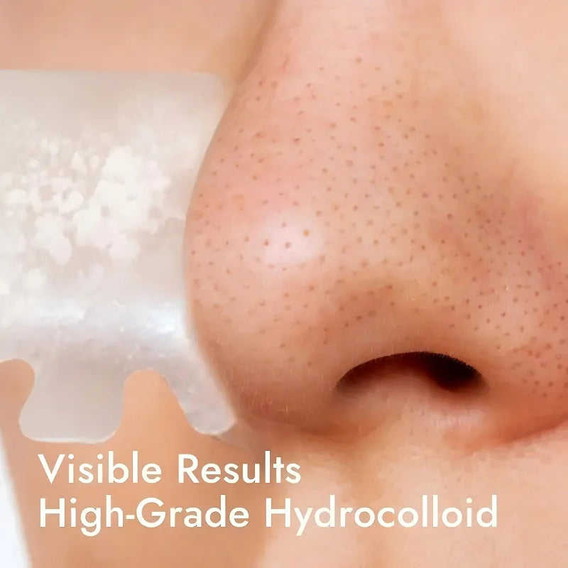 7 pieces/box of hydrogel nose patch - alcohol free, non irritating water-based gel material for deep pore removal Oasis Select
