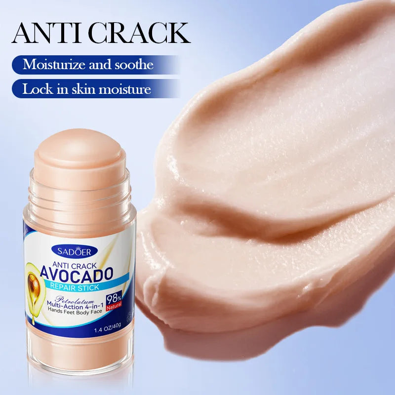60% Urea Foot Cream with Aloe Vera – Deep Hydration 40g