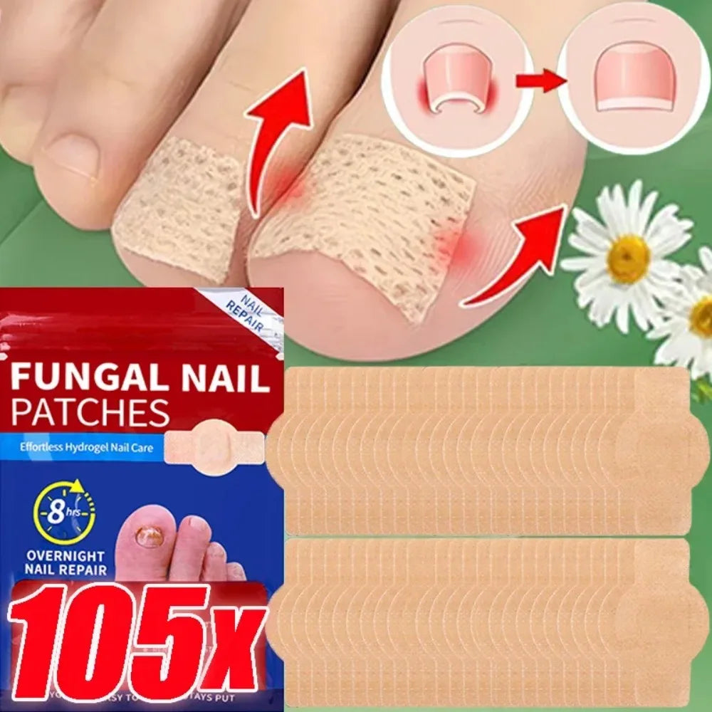 Nail Repair Patches – Ingrown Toenail & Nail Care Stickers Nail Care Patches Oasis Select