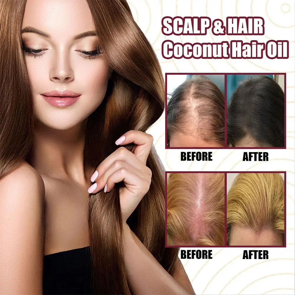 Red Onion Hair Oil Spray – Nourish Roots & Reduce Hair Loss