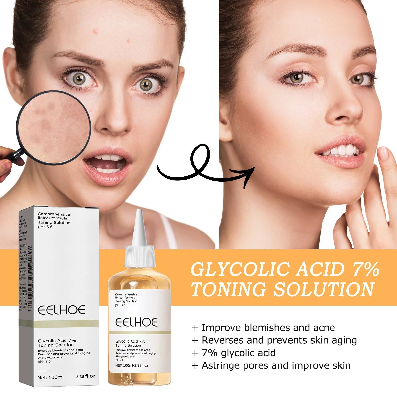 Glycolic Acid 7% Toning Solution Ordinary Acne Remover Lifting Firming Wrinkles Glowing Facial Skin Care Glycolic Acid Toner Oasis Select