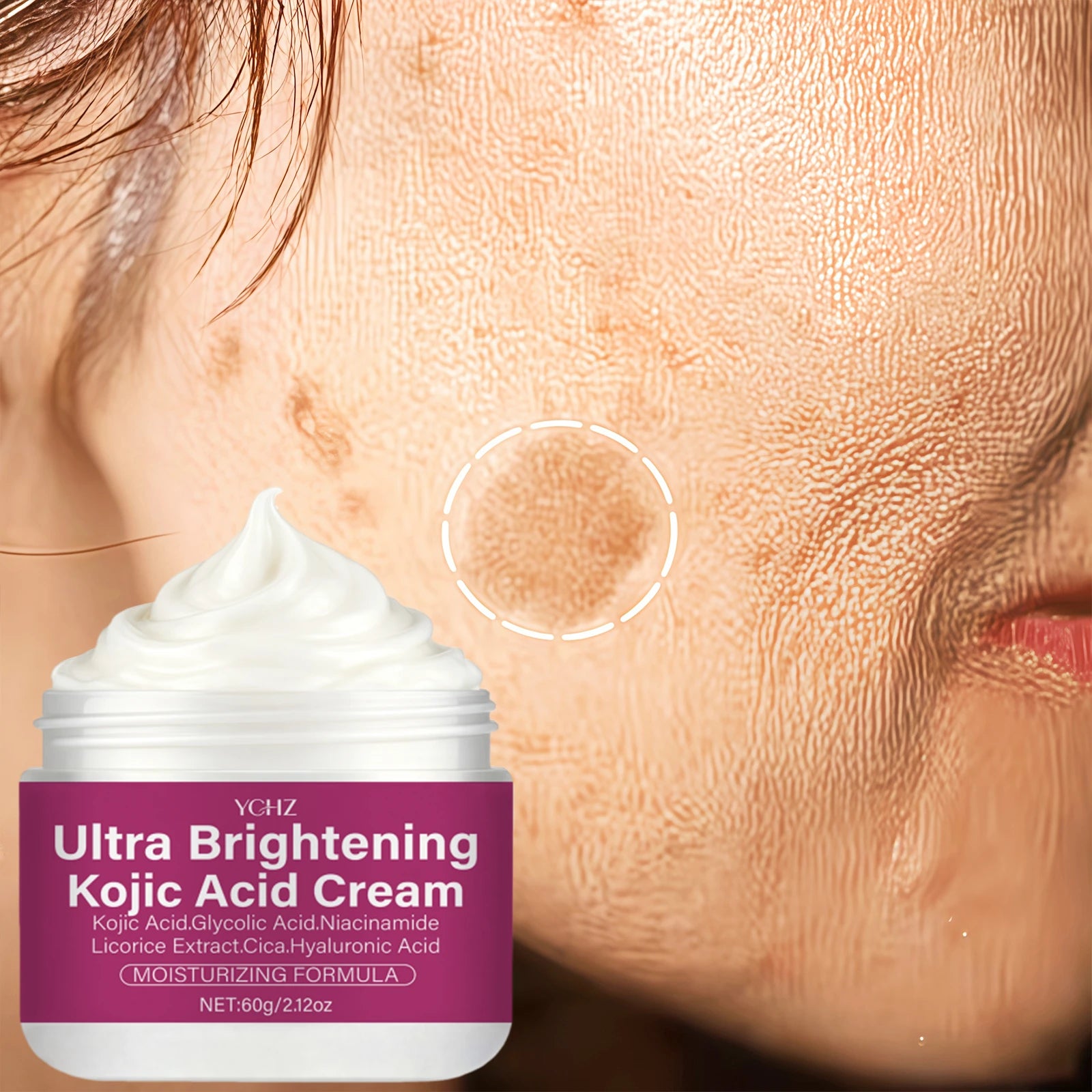 Kojic Acid Brightening Cream – Niacinamide, Vitamins C & E