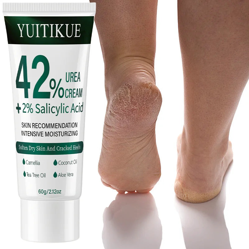 YUITIKUE 42% Urea Cream – Dry Skin & Cuticle Softener 60g