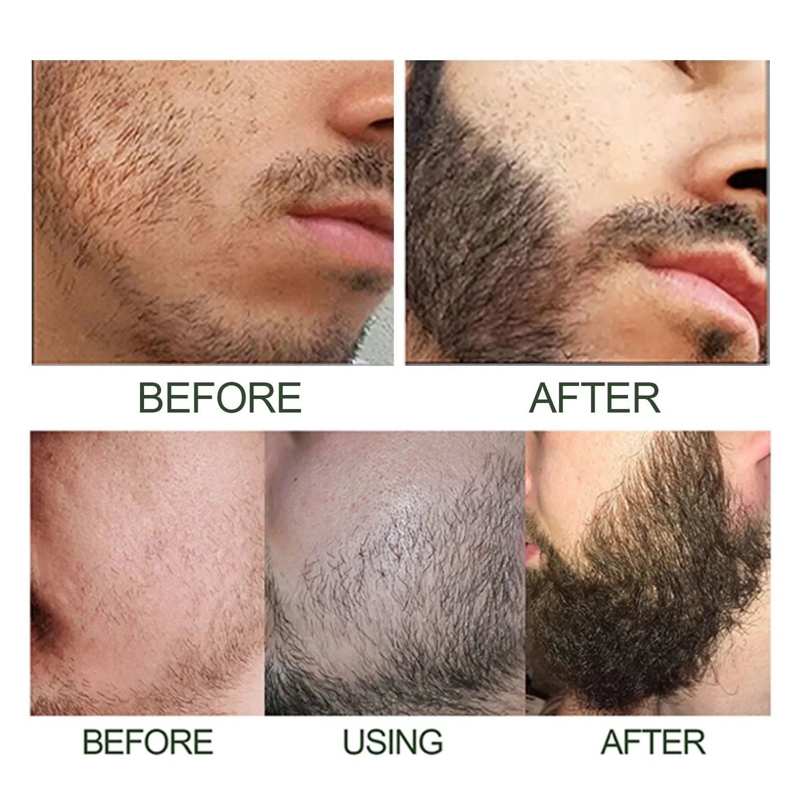 Men's Beard Care Essence Set – Nourishing 60ml Beard Oil Beard Care Essence Oasis Select