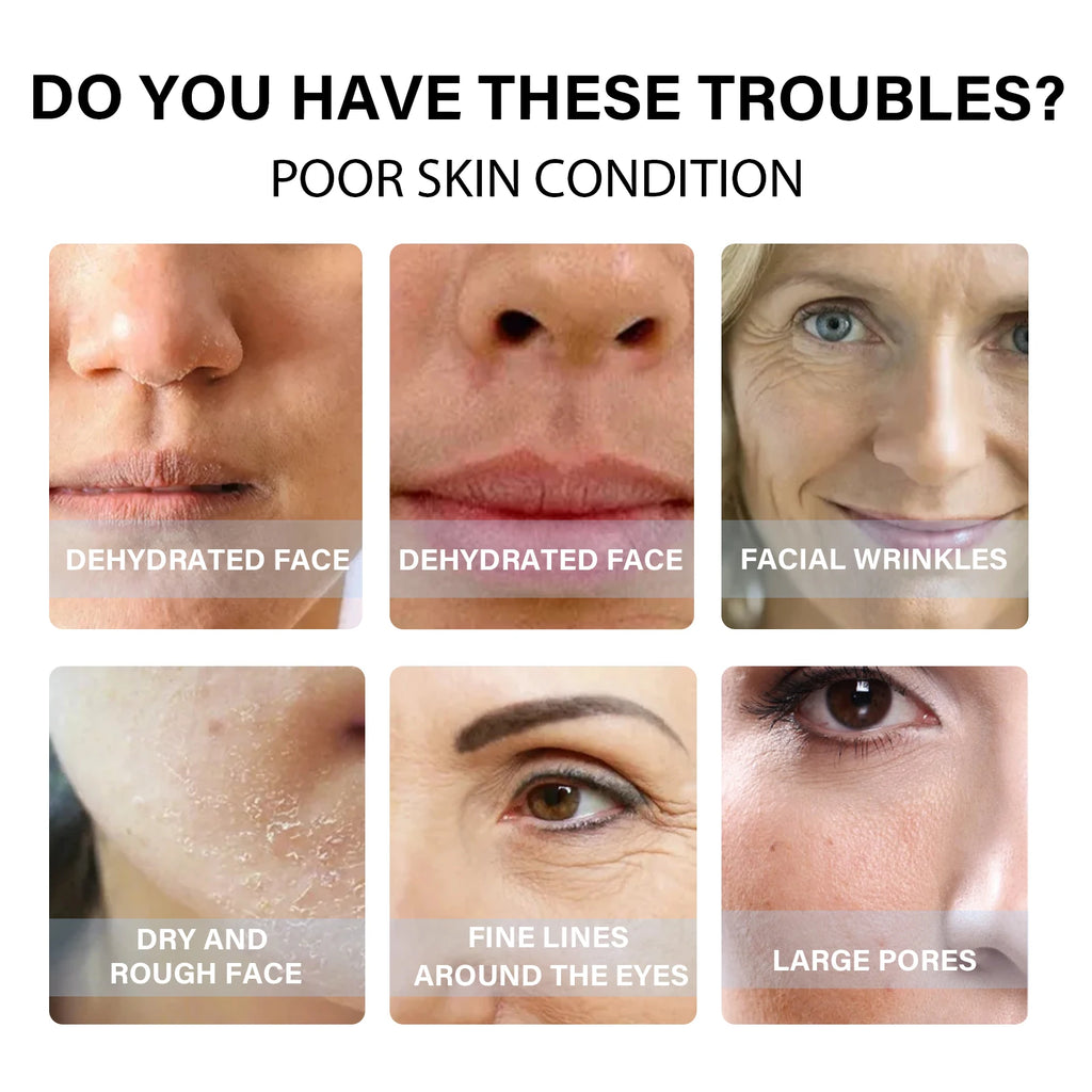 Hydrolyzed Collagen Protein Threads Fade Face Fine Lines Lift Firming Shrink Pores Deep Repair Absorbable Face Filler Skincare Oasis Select