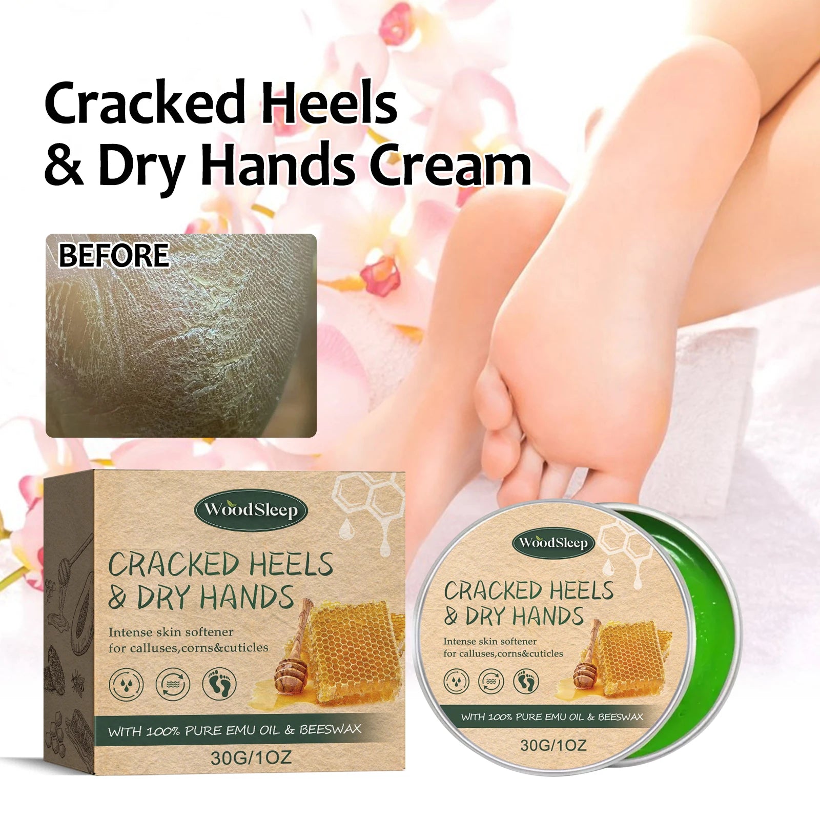 WOODSLEEP Cracked Heel & Hand Repair Cream – Deep Moisturizer Foot & Hand Cream Oasis Select