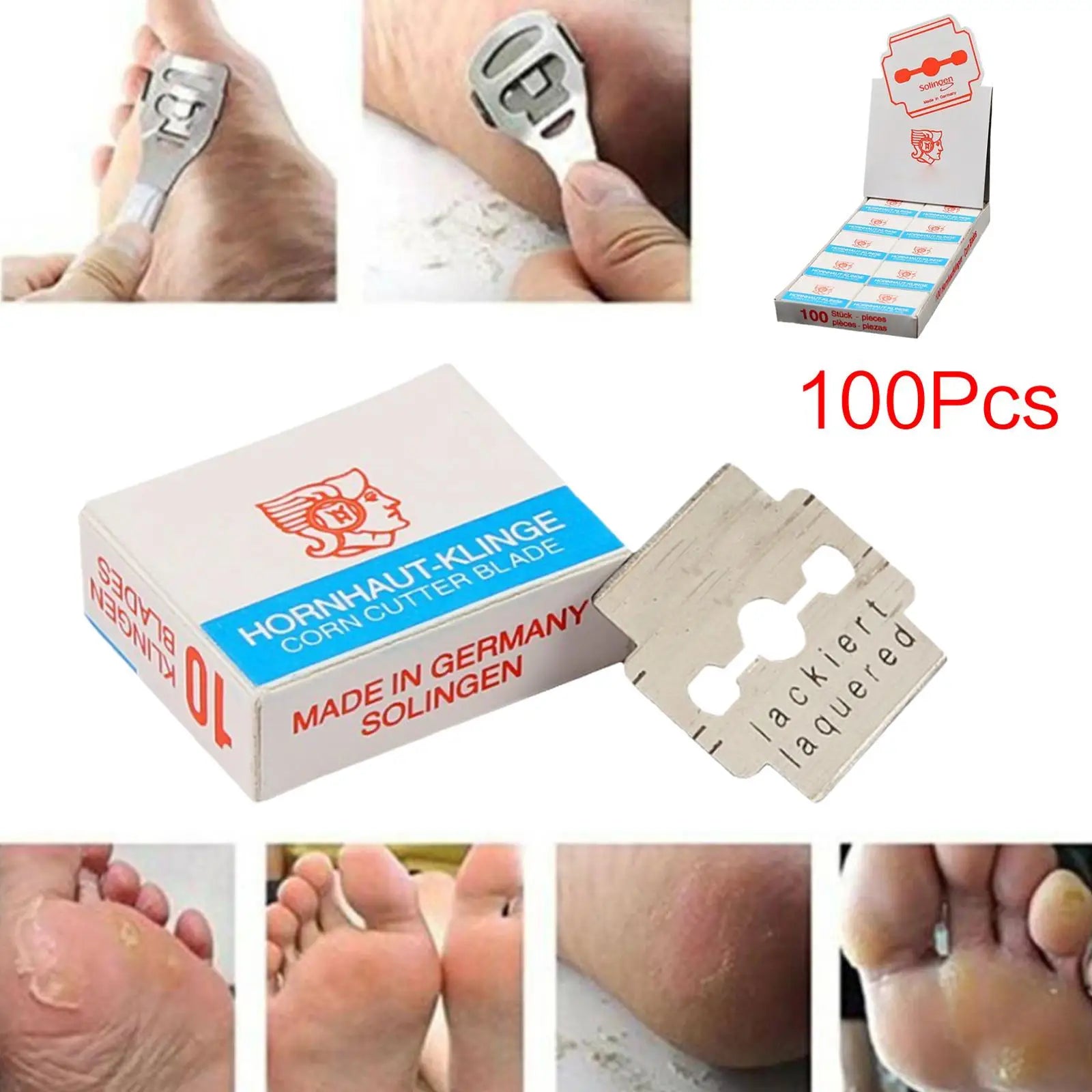 100x Callus Shaver Replacement Blades – Stainless Steel Pedicure Pedicure Replacement Blades Oasis Select
